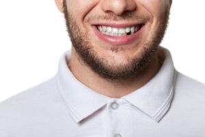 Top Solutions for a Missing Tooth: Exploring Your Options