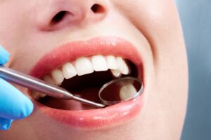 Teeth Filling vs Root Canal: Which One Do You Really Need?