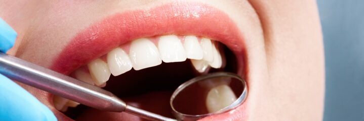 Teeth Filling vs Root Canal: Which One Do You Really Need?